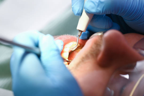 Best Tooth Pain Emergency Relief  in Oglesby, IL